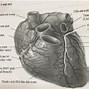 Động Mạch Phổi Xuất Phát Từ Tâm Thất Trái